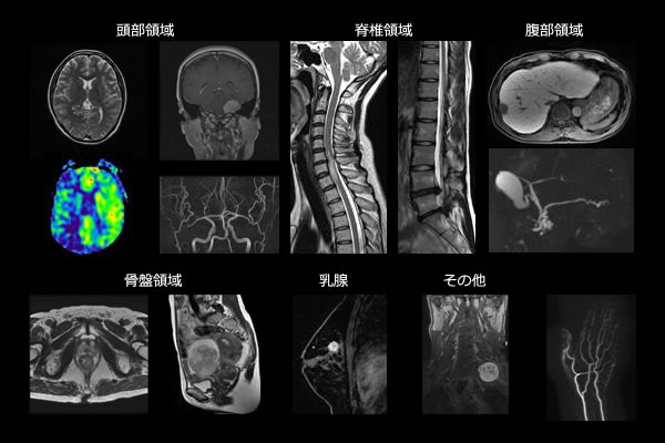 MRI検査で得られる画像